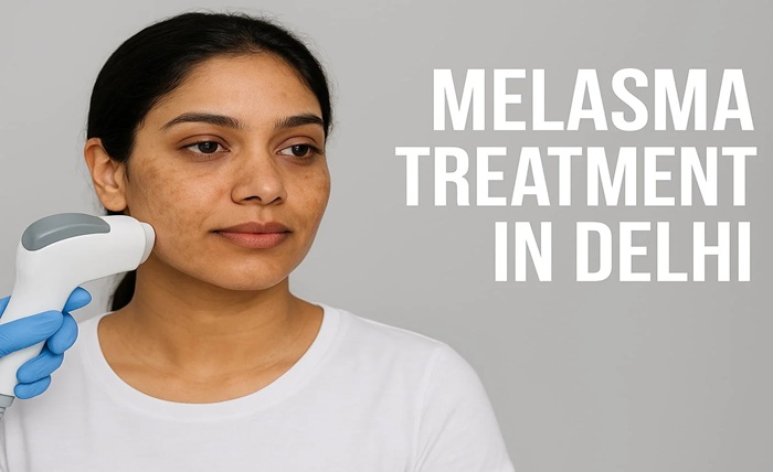Top Melasma Treatment: How to Set Realistic Goals with your Doctor Top Melasma Treatment